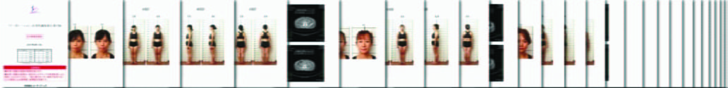 イーポレーションの美顔･痩身効果に関する有用性調査報告書